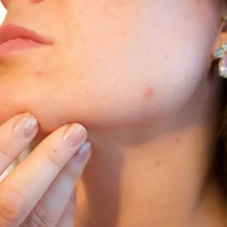 Mandíbula y cuello