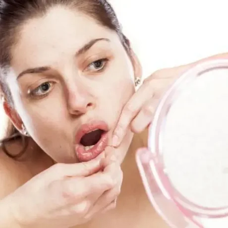 Labios o alrededor de la boca