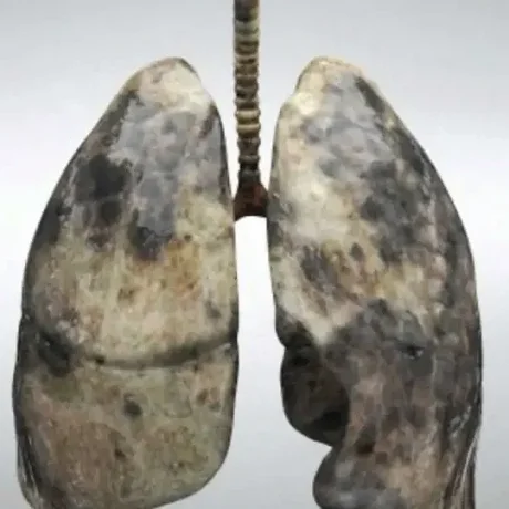 Efectos nocivos para la salud respiratoria