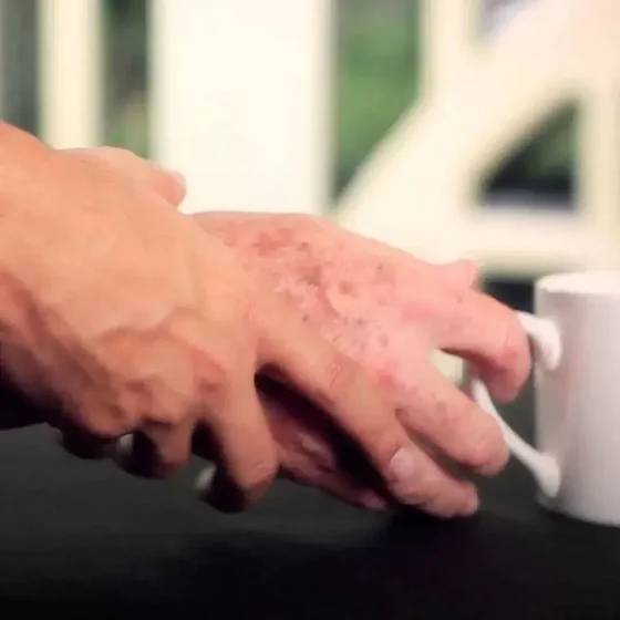 Parkinson: Los 10 signos que alertan la enfermedad