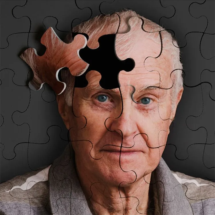 Científicos italianos descubren el supuesto origen del Alzheimer