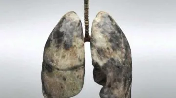 Efectos nocivos para la salud respiratoria