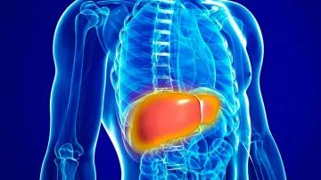 ¿Qué es el hígado graso y como curarlo?