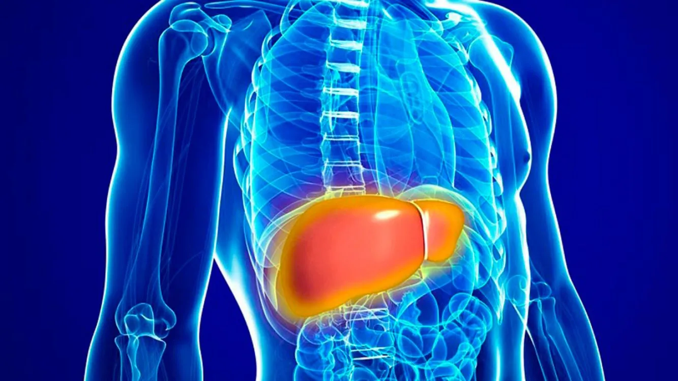 ¿Qué es el hígado graso y como curarlo?